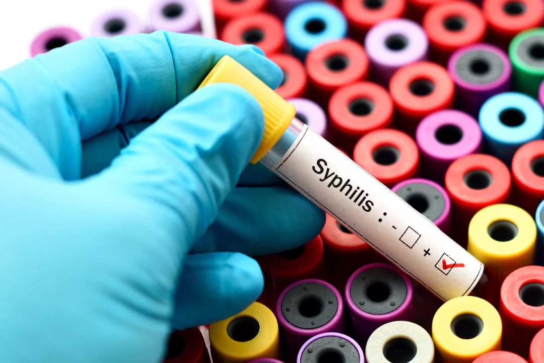 syphilis